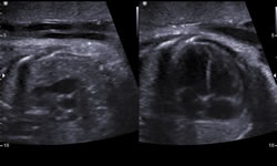 scan fetal palermo