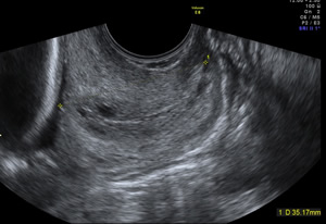 donde hacer cervicometria capital hacer cervicometria palermo