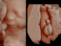 donde hacer scan fetal Palerm